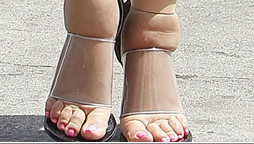 What is The Best Shoes For Swollen Feet